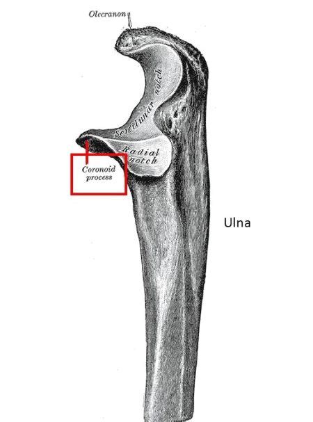 Coronoid Process Of Ulna - slidesharetrick