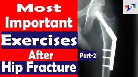 Most Important Exercises After Hip Fracture Part-2 | HEALTH MADE EASY | Hip fracture, Exercise ...