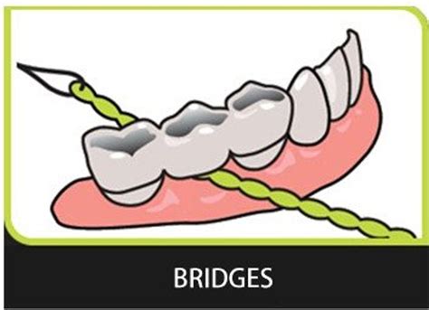 Idontix X-Floss Easy Bridge and Implant Floss - 30 Strands