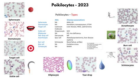 Poikilocytes • The Blood Project