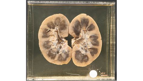 National Museum of Health and Medicine: The Micrograph - A Closer Look at NMHM