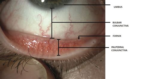 Fornix Eye Anatomy