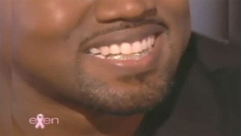 Kanye West Shows off Million Dollar Smile | eXtravaganzi