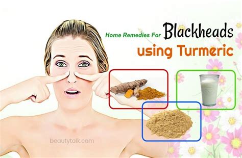 Top 36 Natural Home Remedies For Blackheads On Face And Nose