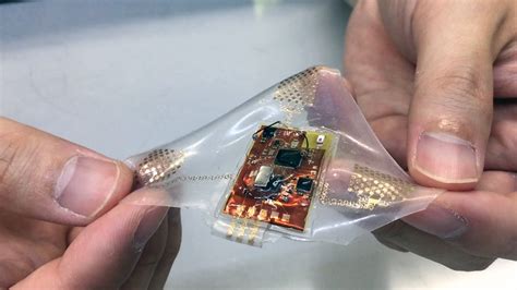 Soft wearable health monitor uses stretchable electronics