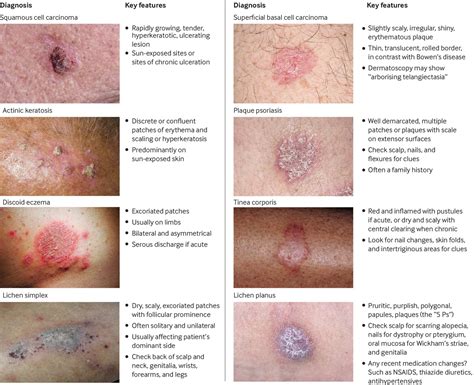 Bowen’s disease | The BMJ