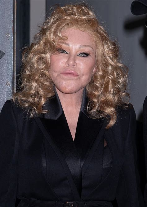 The Wildenstein-Klein Saga: Truth Behind Her Plastic Surgery