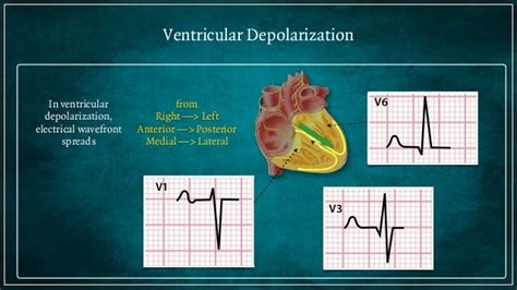 Electrocardiogram