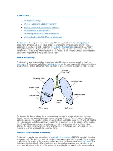 Lobectomy | Lung | Lung Cancer