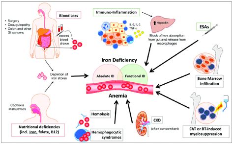 Pathogenesis Of Iron Deficiency Anemia | My XXX Hot Girl