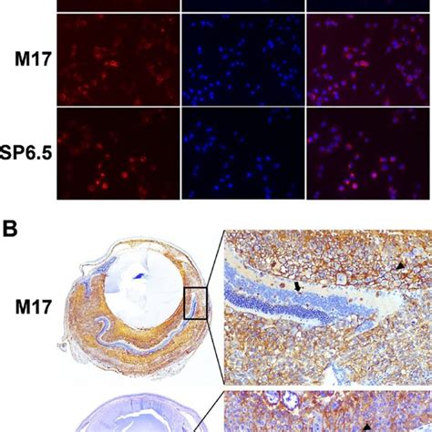 CD146 is highly expressed in uveal melanoma cells. (A) CD146 expression... | Download Scientific ...