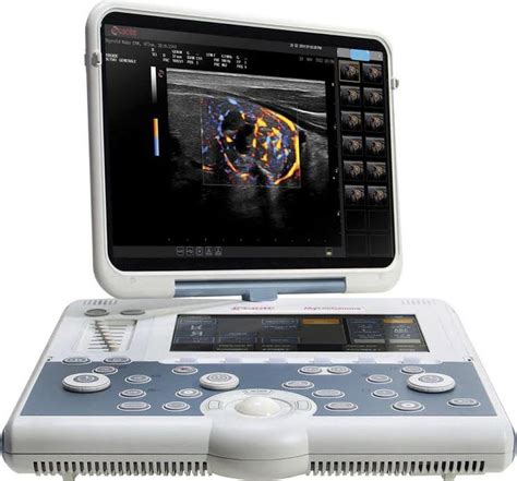 Worldwide Launch of Esaote’s newest ultrasound systems | Узи, Технологии, Родео