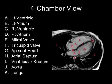 Cardiac mri&slice anatomy