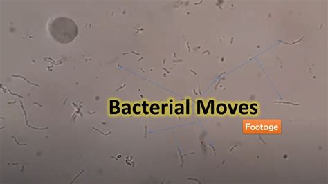 Live Motile Bacteria in Urine Microscopy - YouTube