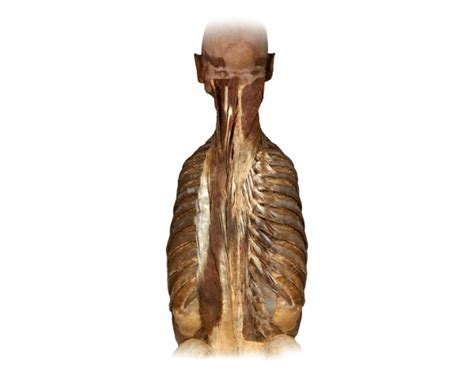 Muscles of the Erector Spinae Group Quiz