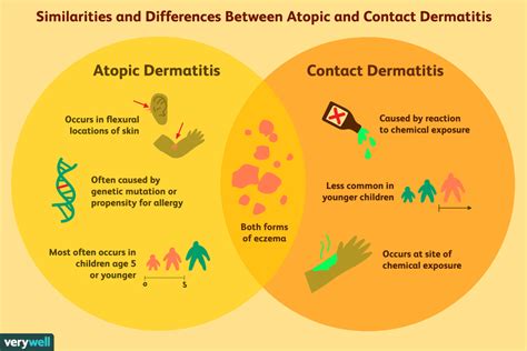 Atopic and Contact Dermatitis: How They Differ