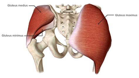 IM Injection Gluteus Medius