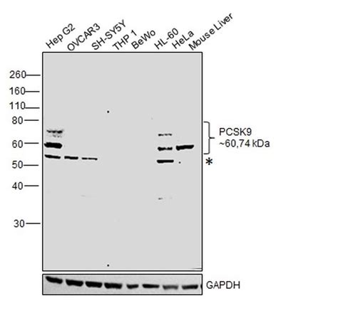 PCSK9 Polyclonal Antibody (PA5-47559)