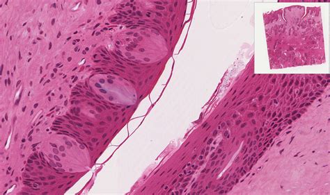 Oral Cavity and Salivary Glands | histology