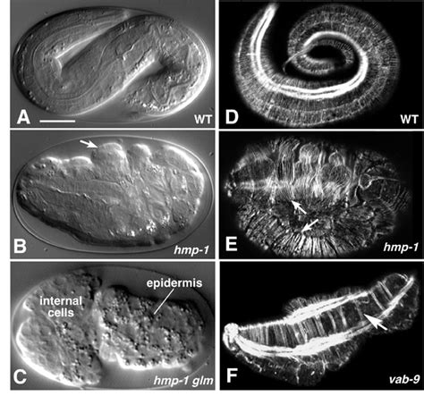 Morphogenesis | 4Chuckle