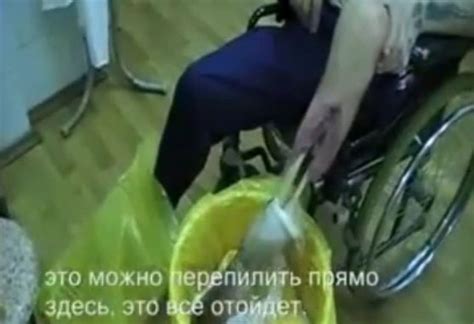 Russian Drug Krokodil Causes Skin to Rot | Interesting Pictures