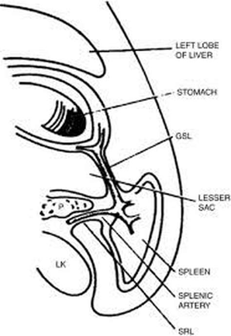 Gastrosplenic ligament - MEDizzy