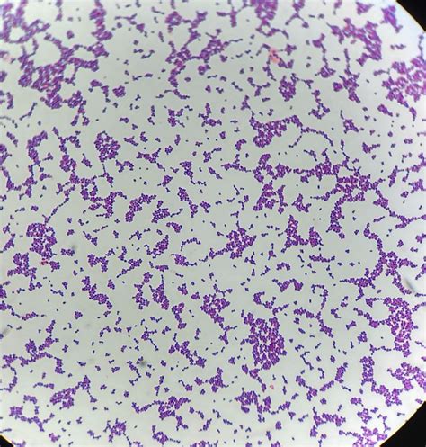 Enterococcus gram stain | Microbiology lab, Microbiology, Microbiology ...