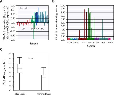 PRAME expression in leukemia cell lines and patient samples. (A) PRAME ...