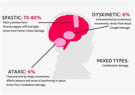 Different types of cerebral palsy | Cerebral Palsy Cymru