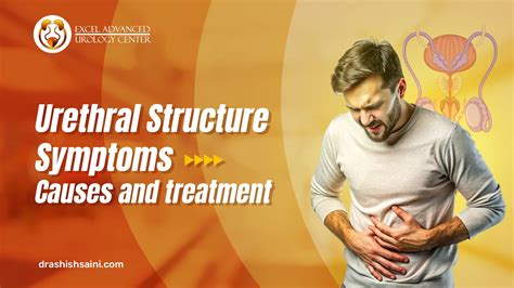 Urethral Stricture Symptoms: Causes and Treatment