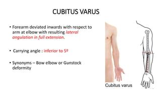 Cubitus valgus varus | PPT