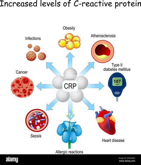 Αντιδρώσα Πρωτείνη C (C-Reactive Protein C-R.P.) - Chem-lab