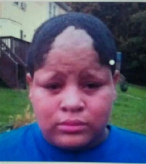 LMFAOOO worst haircut ever | Bad haircut, Bad hairline, Funny hairlines