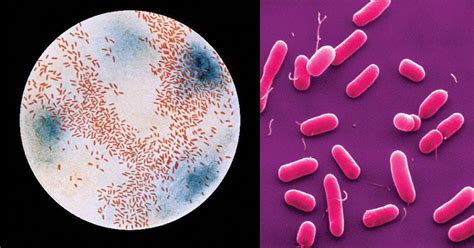 Biochemical Test of Haemophilus influenzae