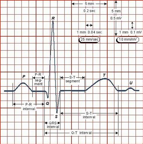 Electrical signals of the heart