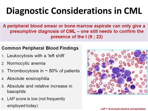 CML Chronic myelogenous leukemia - ppt video online download