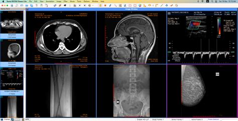 Sante DICOM Viewer Lite | Santesoft LTD