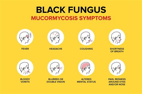 Black fungus re-infection reported in Agra - The Statesman