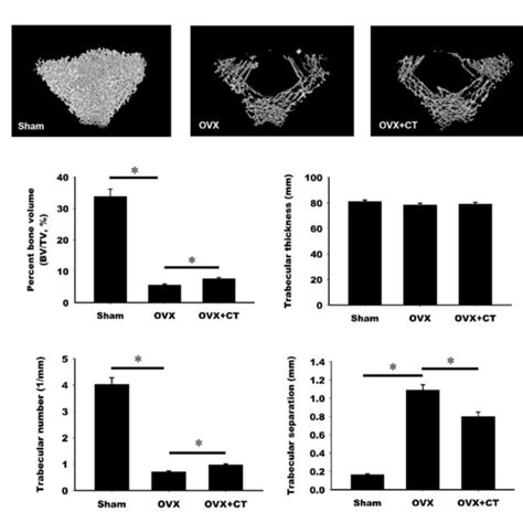 | Model of calcitonin-induced bone formation through action on... | Download Scientific Diagram