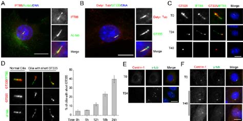 Fig. S1. Dynamic reorganization of primary cilia and centrosome... | Download Scientific Diagram