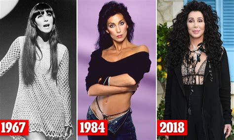 Cher's Plastic Surgery Journey: Before and After Analysis ...