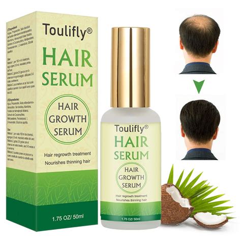 Hair Growth Serum, Anti-Hair Loss Serum - for Thickening and Regrowing ...