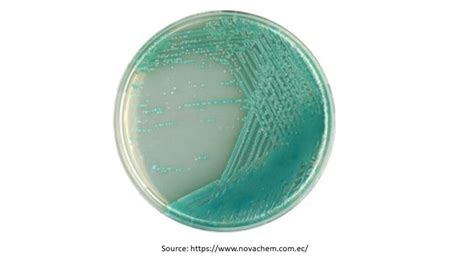 Pseudomonas agar: Introduction, Principle, Composition, Preparation, Pro