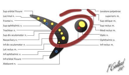 Superior orbital fissure nerves (mnemonic) | Radiology Reference Article | Radiopaedia.org ...