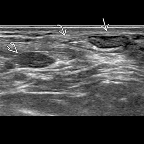 Ankle Ultrasound | Radiology Key