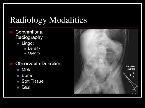 PPT - Introduction to Radiology PowerPoint Presentation - ID:330769