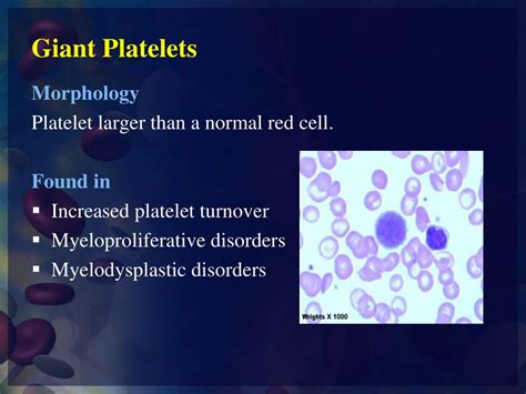 PPT - WBCs & PLT Abnormal Morphology PowerPoint Presentation, free ...