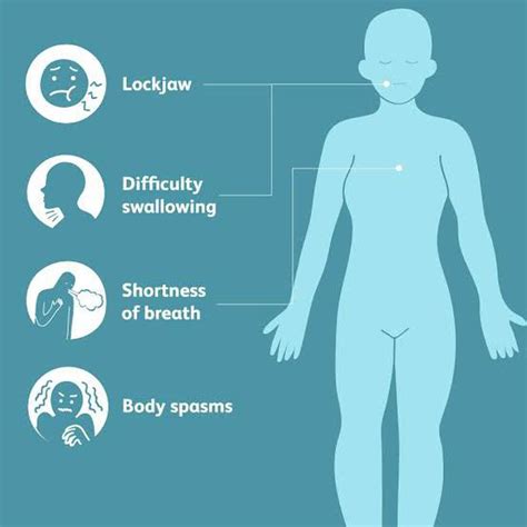 Tetanus symptoms - MEDizzy