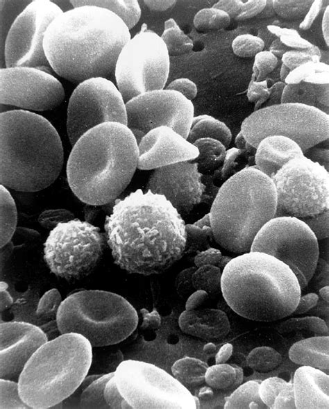 barbilophozia floerkei, cells, liverwort, microscopic, macro, biology, science | Pikist