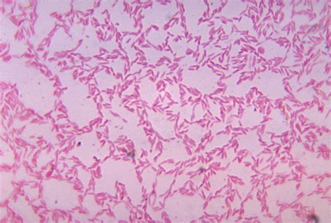 File:Bacteroides biacutis 01.jpg - Wikipedia